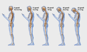 Una serie di schiene e colli piegati a causa della postura da smartphone e la nuova patologia text back